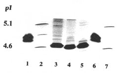 Electrophoresis plate. Click for larger version