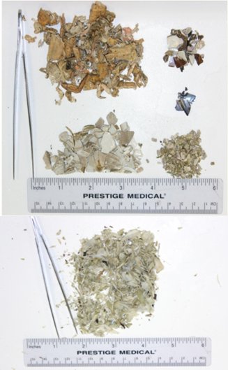 Sorted piles of scat contents with six inch scales to show particle sizes (Click for larger version)